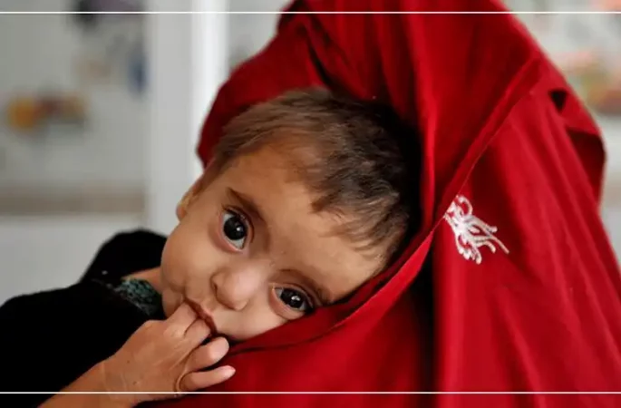 ۴ میلیون تن به شمول ۳.۲ میلیون کودک در افغانستان سوءتغذیه حاد مبتلا هستند