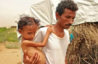 نخست وزیر یمن : دستکم ۵۰ درصد کودکان یمن از سوء تغذیه رنج می‌برند