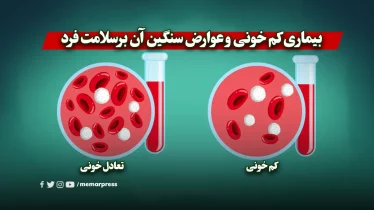 بیماری کم خونی و عوارض سنگین آن برسلامت فرد