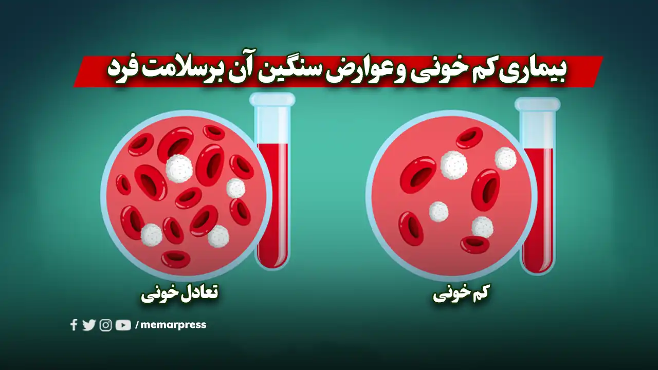 بیماری کم خونی و عوارض سنگین آن برسلامت فرد