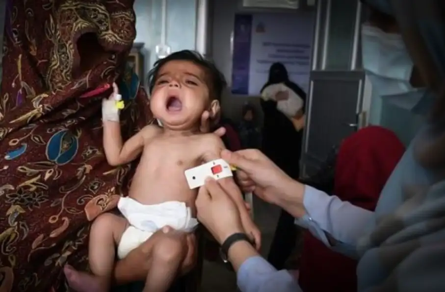 برنامه جهانی غذا: سوءتغذیه جان ۳.۵ میلیون کودک در افغانستان را تهدید میکند