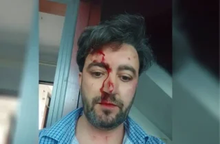 سفارت افغانستان در تهران: رویداد خشونت علیه دانشجوی افغان خارج از ساختمان سفارت رخ داده است