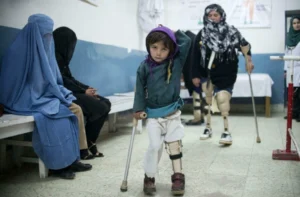 یوناما: یک‌چهارم جمعیت افغانستان با معلولیت زندگی می‌کنند