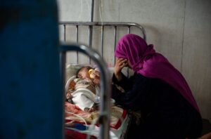 خطر سوءتغذیه جان ۴ میلیون کودک افغان را تهدید می‌کند