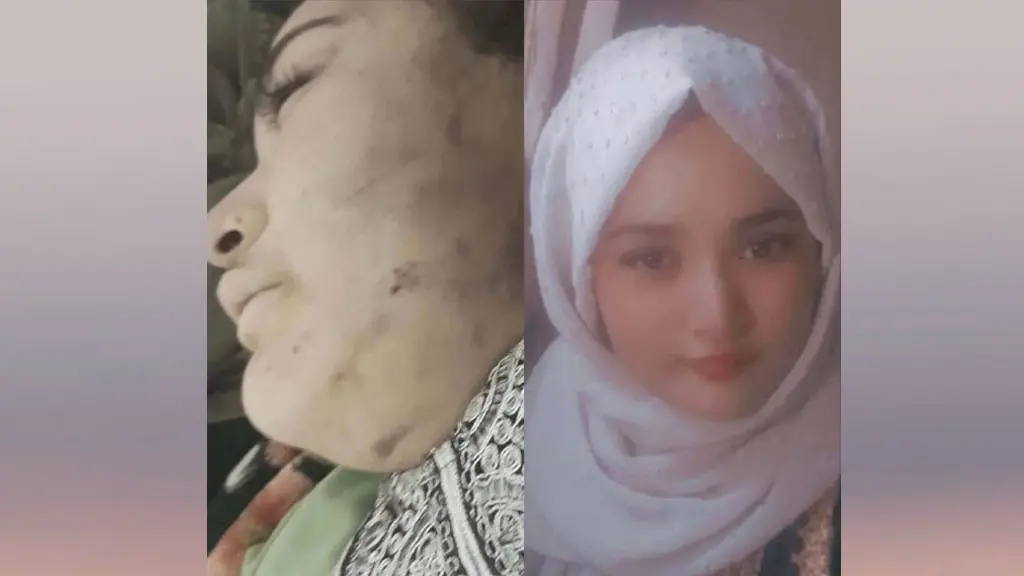 د افغانستان ښځې د کورنيو تاوتريخوالو او د طالبانو د سختدريځۍ قربانيانې دي