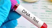 dna-test