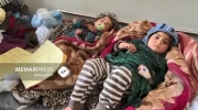 افزایش بیماری سرخک در افغانستان