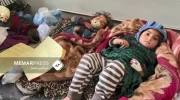 افزایش آمار مبتلایان به سرخکان در افغانستان