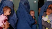 هشدار سازمان ملل: ۳.۵ میلیون کودک در افغانستان با سوءتغذیه روبه‌رو هستند
