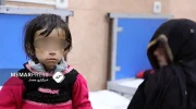 برنامه جهانی غذا : دستکم ۴ میلیون مادر و کودک در افغانستان با سوء تغذیه حاد مواجه هستند